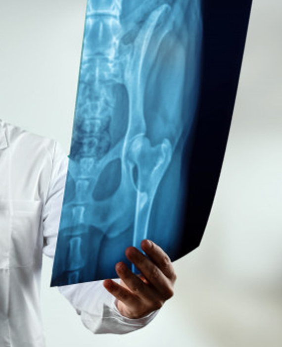 Tratamiento ortopédico de fracturas
